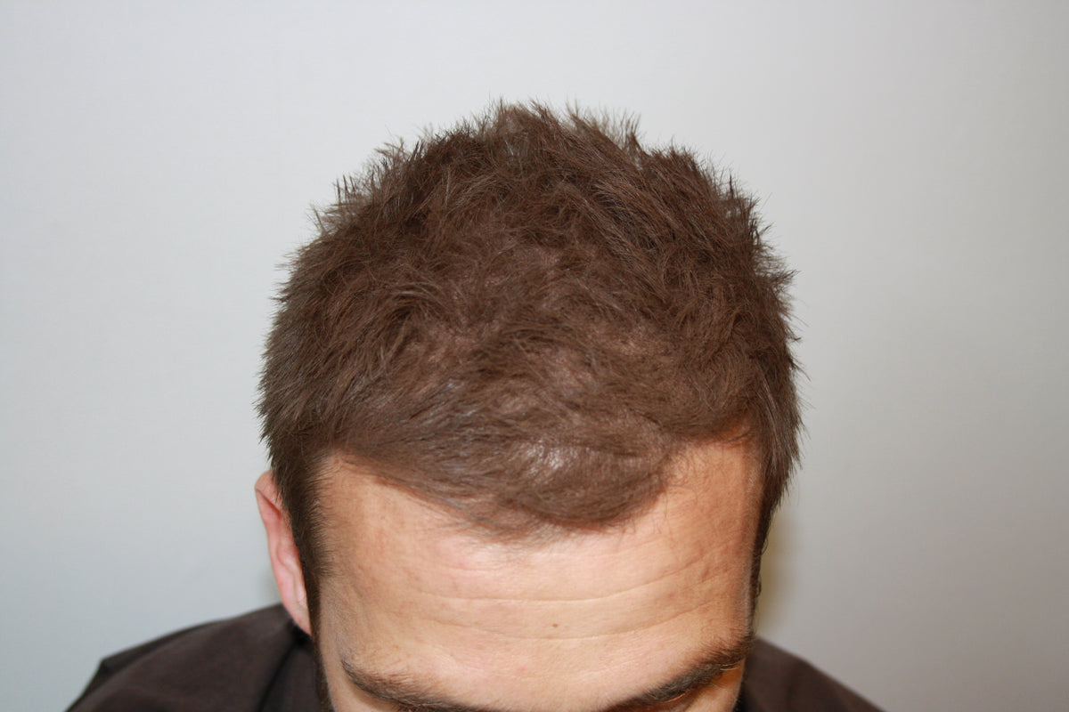 After Image