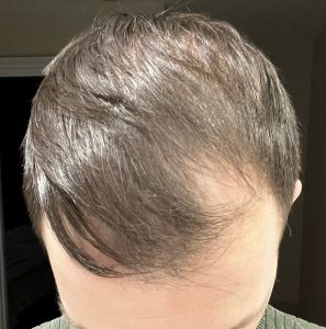 After Image