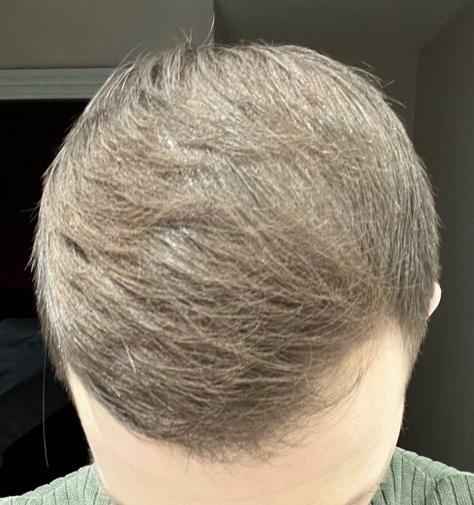 Before Image