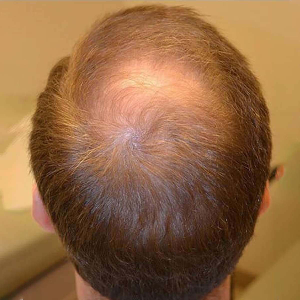 Before Image
