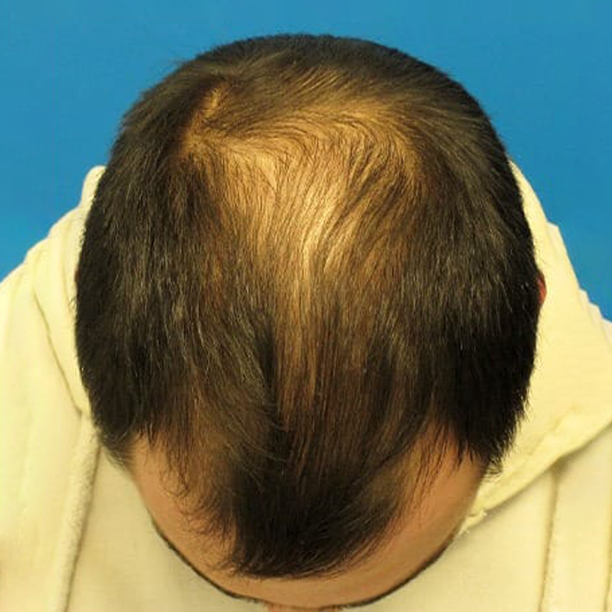Before Image