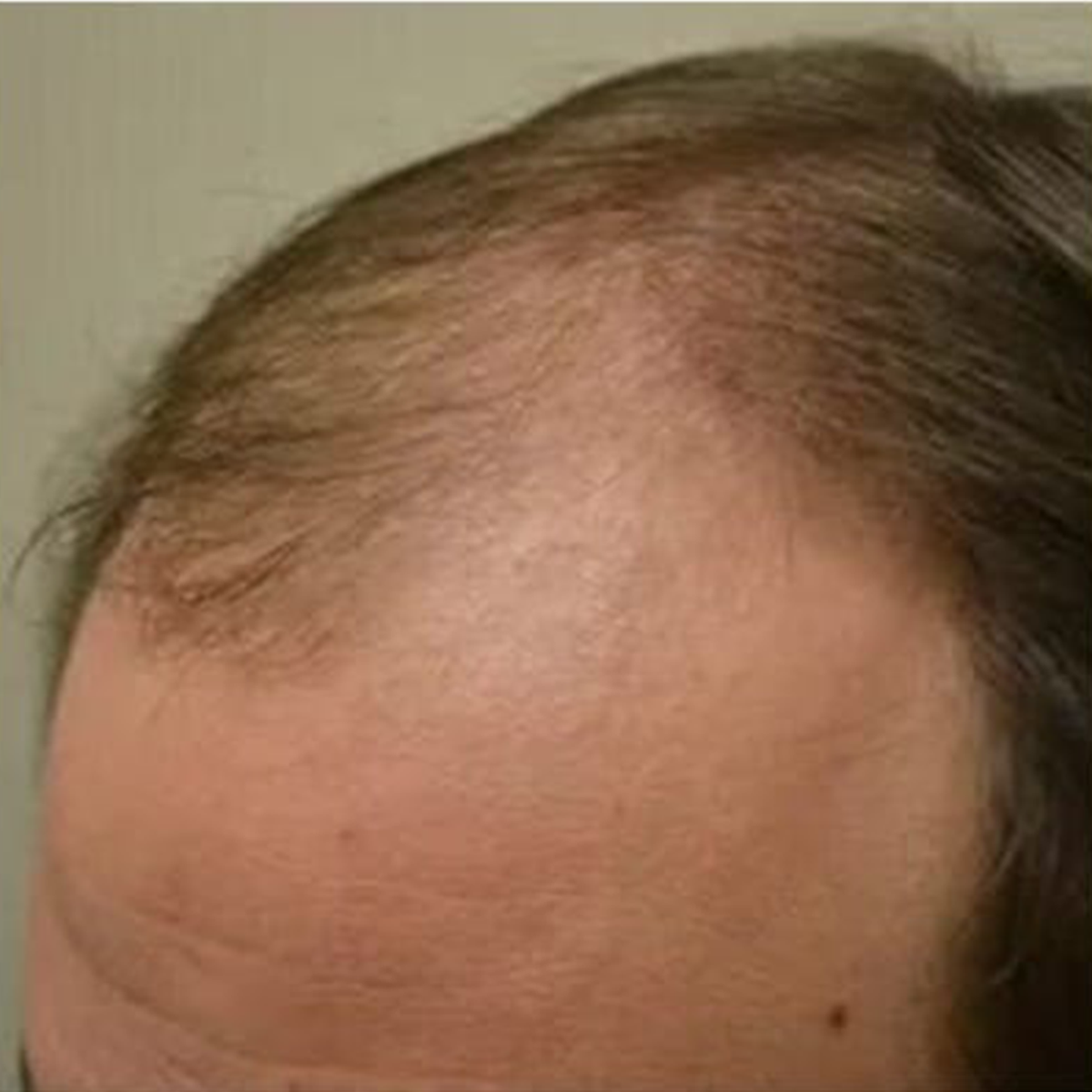 Before Image