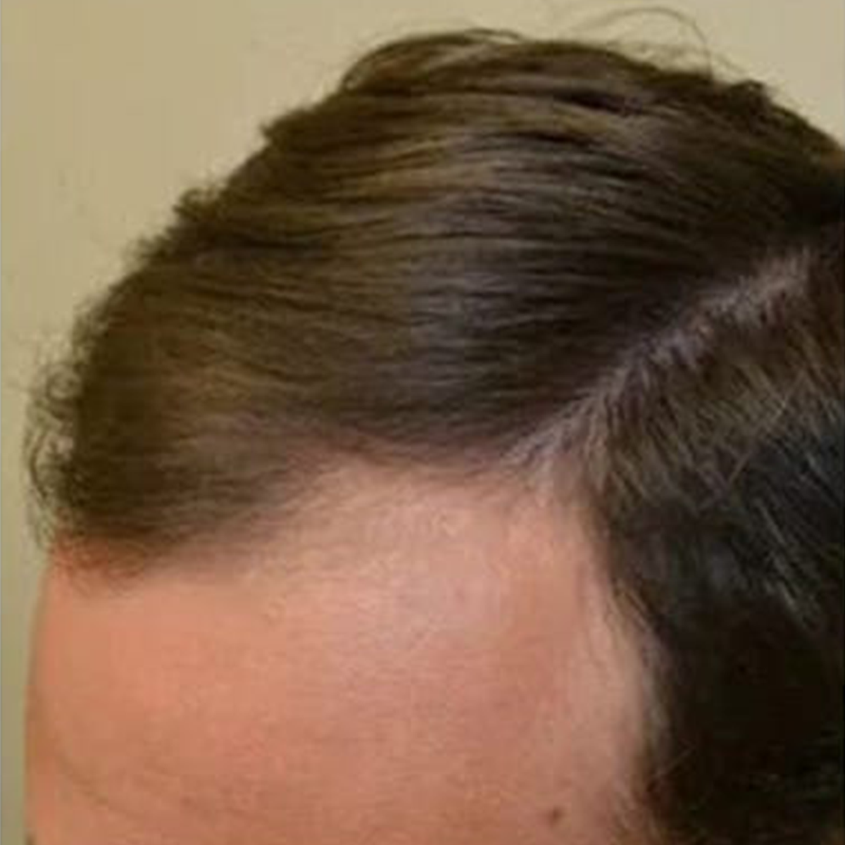 After Image
