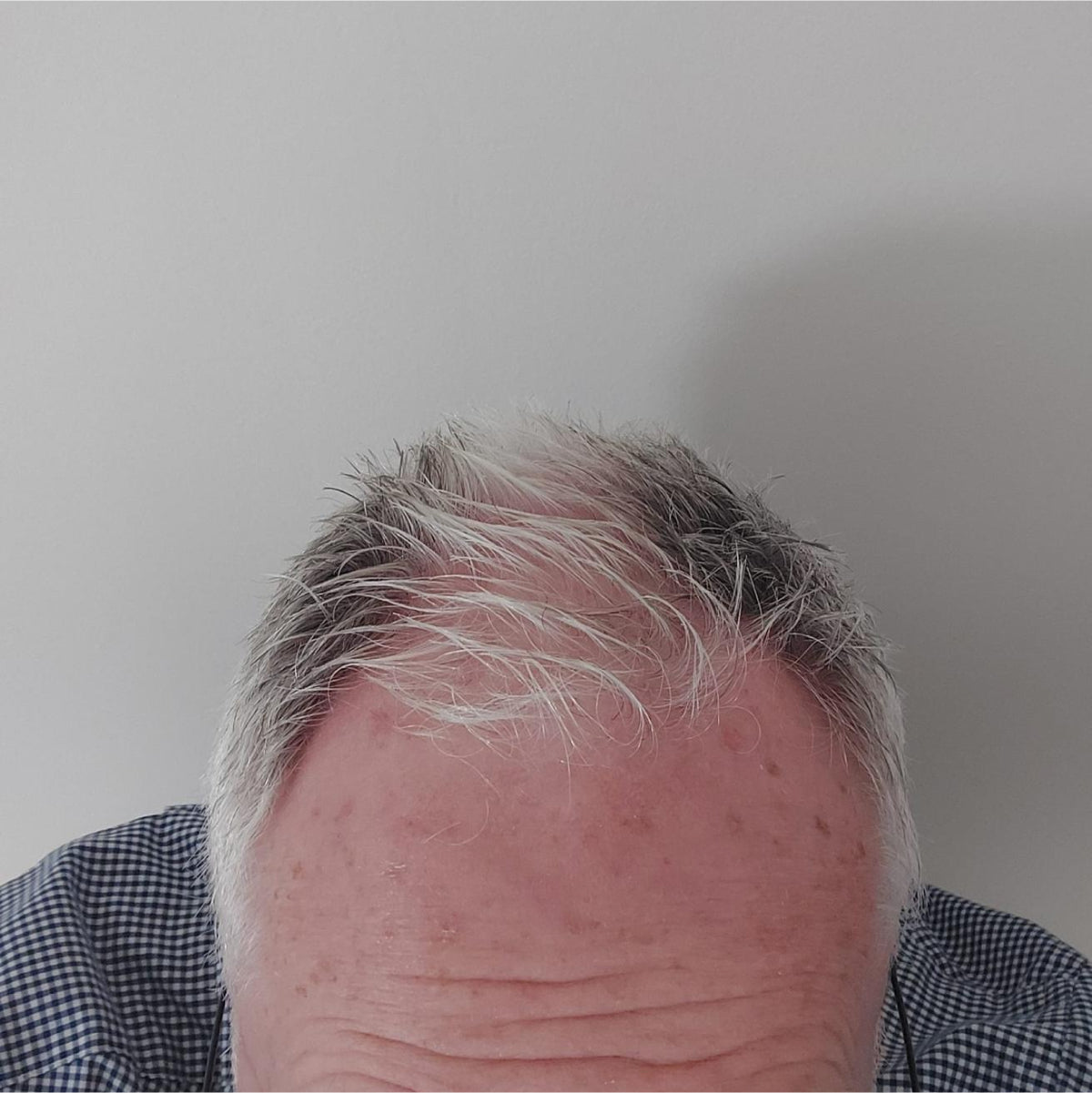 Before Image
