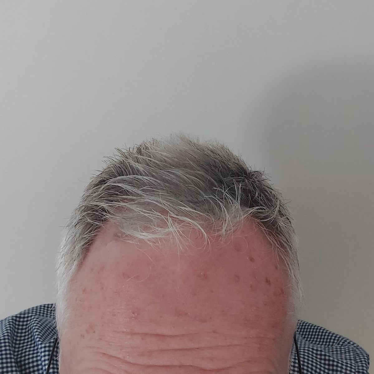 After Image