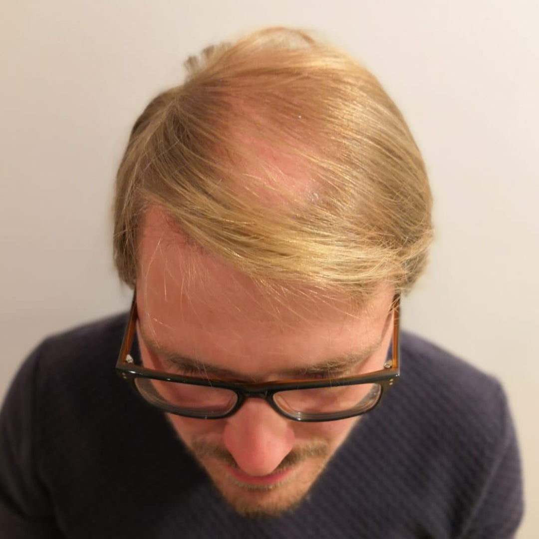 Before Image