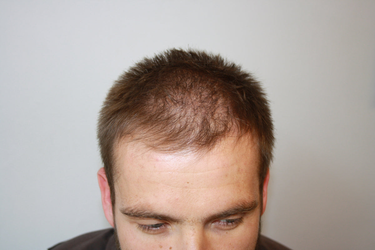 Before Image