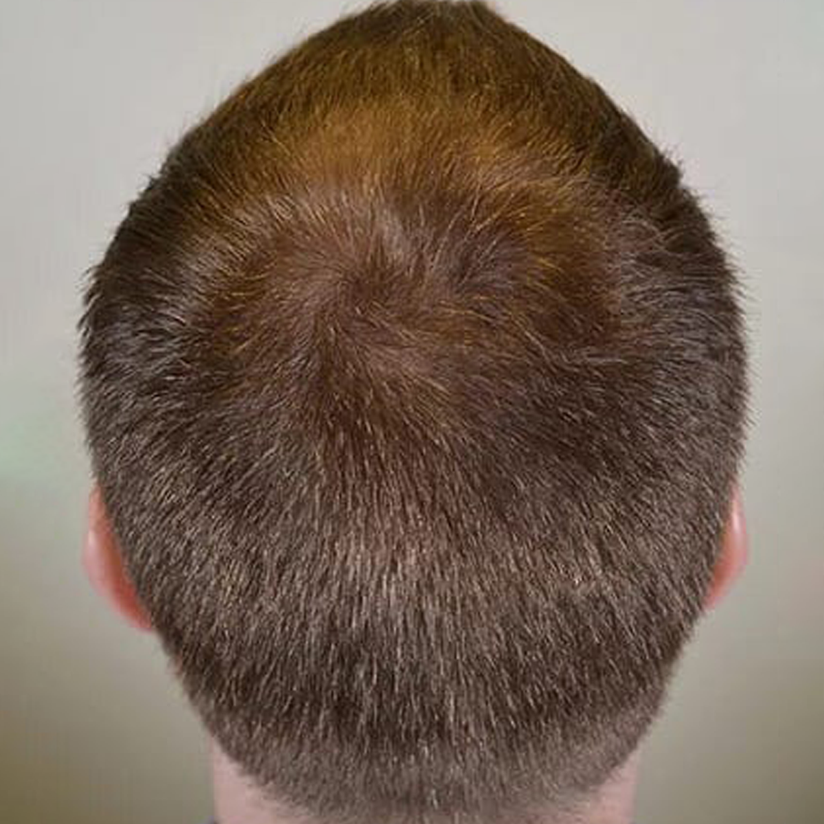 After Image