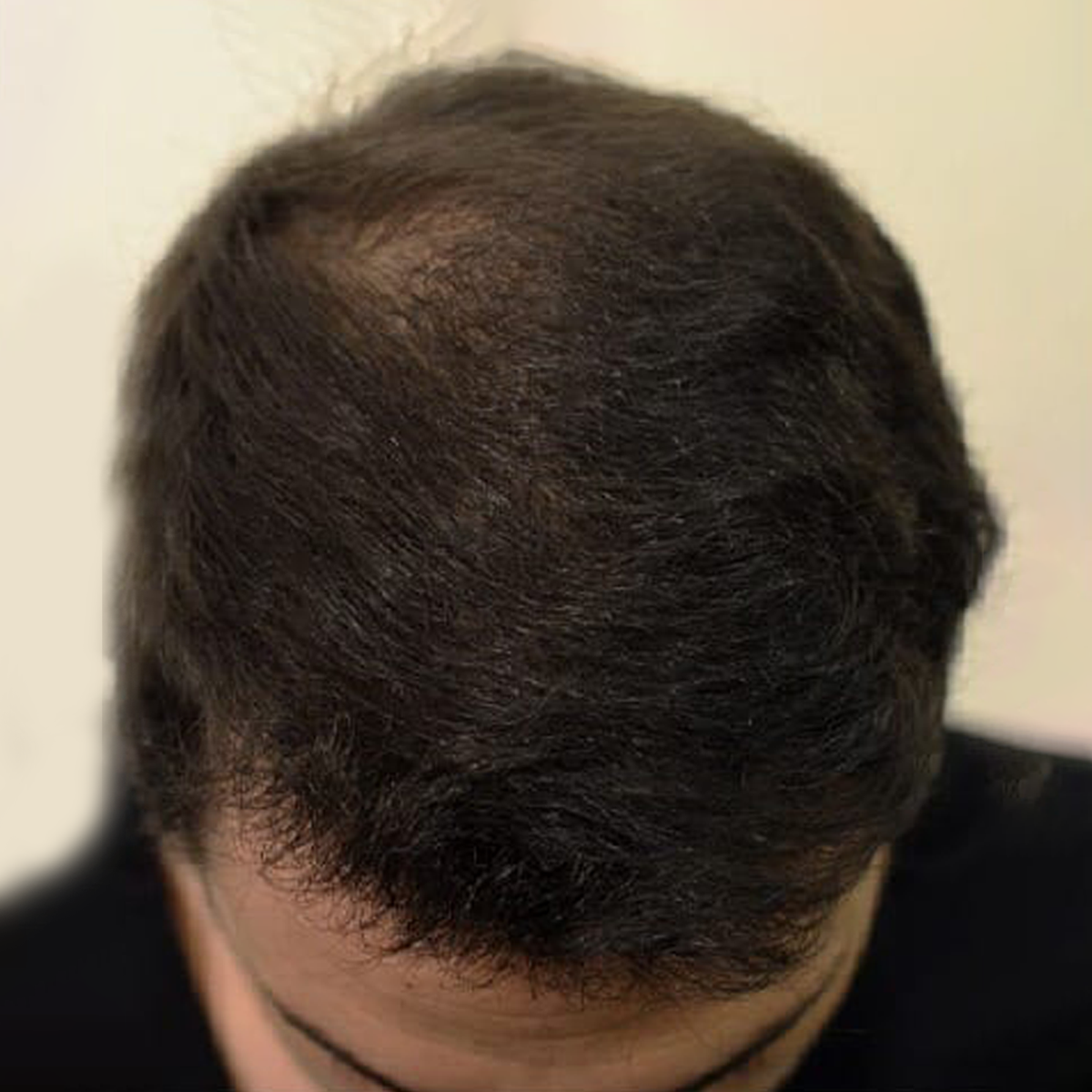 After Image